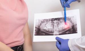 How Long Until a Tooth Infection Kills You