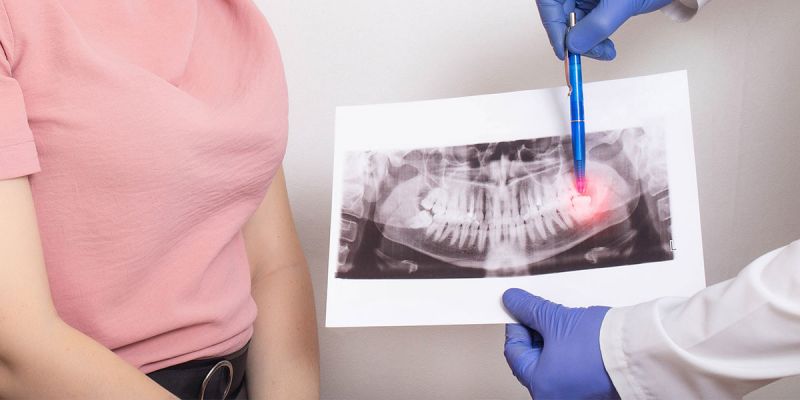 How Long Until a Tooth Infection Kills You
