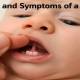 signs-and-symptoms-of-a-lip-tie