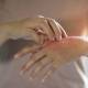 Natural Treatment for Psoriasis