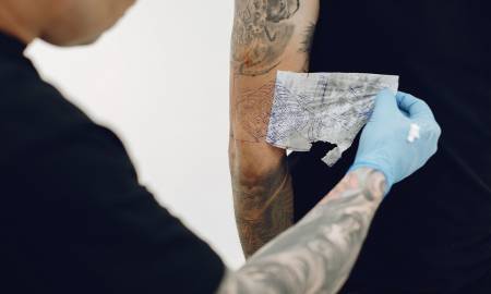 professional tattoo removal