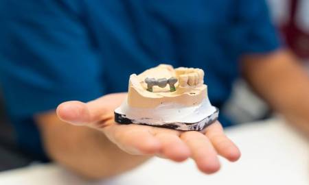 Titanium vs. Zirconia Which Implant Is Best
