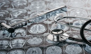 What is the Best Glioblastoma Treatment in the World? Exploring Leading Options