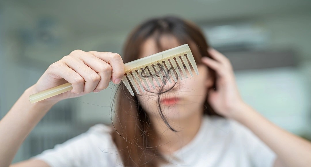 Can Stress Cause Hair Loss? Yes, Here's the Science