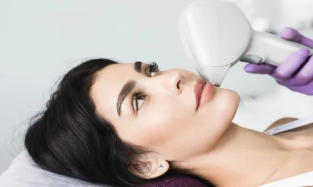 HIFU Treatment for Jawline & Double Chin: Does It Really Work?