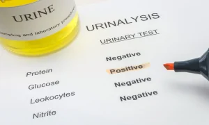 Yeast Infection Cloudy Urine: Is It Actually a UTI?