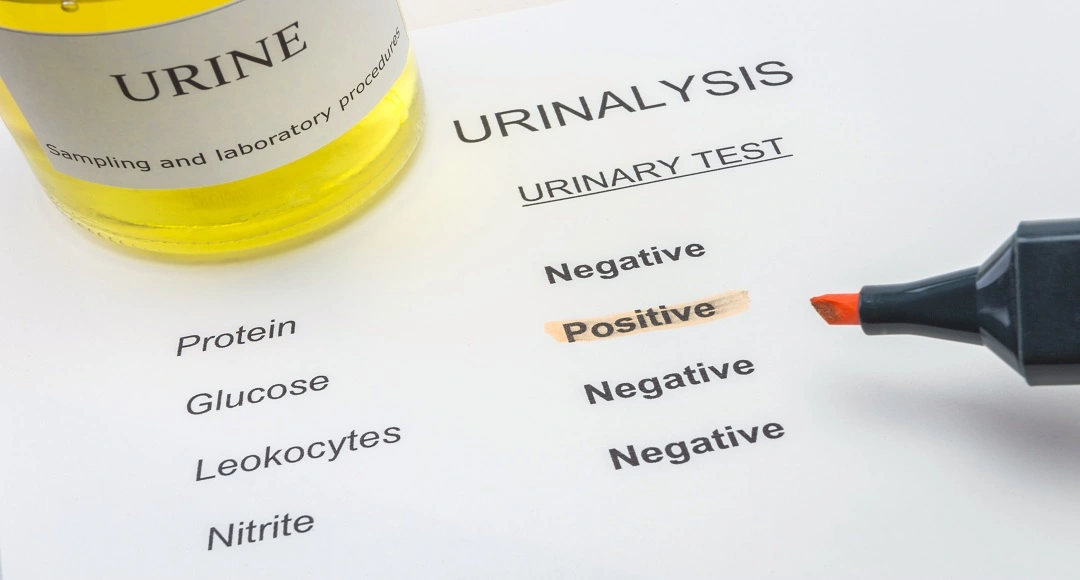 Yeast Infection Cloudy Urine: Is It Actually a UTI?